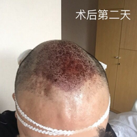發(fā)際線用戶圖片