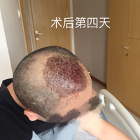 發(fā)際線用戶圖片