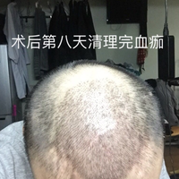 禿頂用戶圖片
