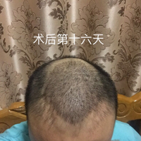 發(fā)際線用戶圖片