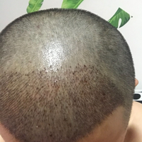 發(fā)際線用戶圖片