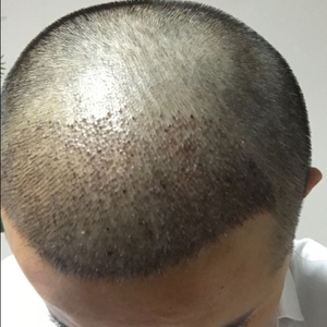 发际线分享社区