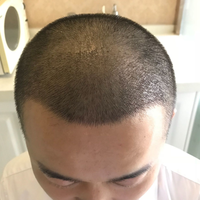 發(fā)際線用戶圖片