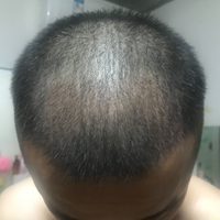 發(fā)際線用戶圖片