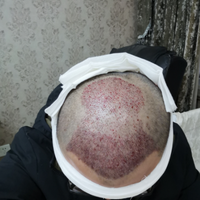 發(fā)際線用戶圖片