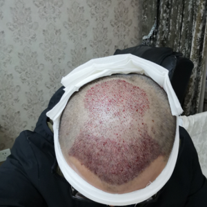 发际线分享社区
