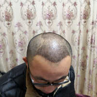 發(fā)際線用戶圖片