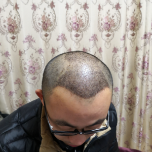 发际线分享社区