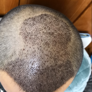 发际线分享社区
