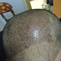 發(fā)際線用戶圖片