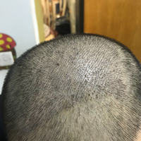 發(fā)際線用戶圖片