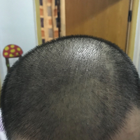 發(fā)際線用戶圖片
