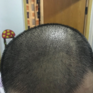 发际线分享社区