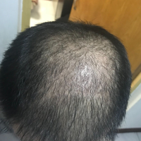 發(fā)際線用戶圖片
