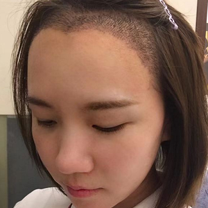 发际线分享社区