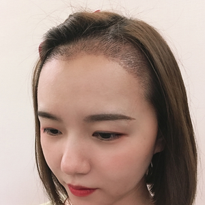 发际线分享社区