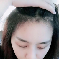 發(fā)際線用戶圖片