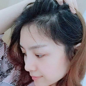 发际线分享社区