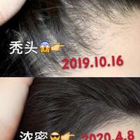 生發(fā)養(yǎng)護(hù)用戶圖片