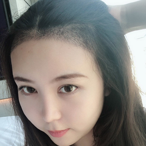 发际线分享社区