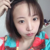 發(fā)際線用戶圖片