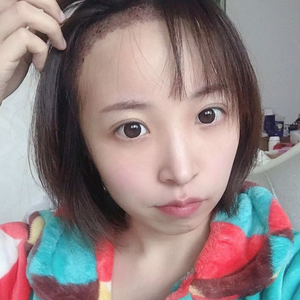 发际线分享社区