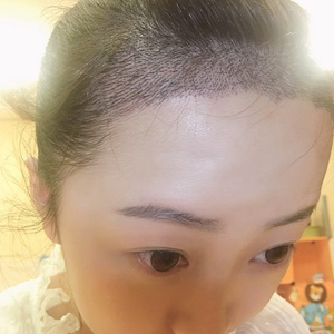 发际线分享社区