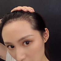 發(fā)際線用戶圖片
