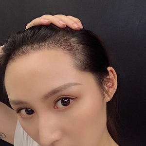 发际线分享社区