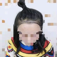 發(fā)際線用戶圖片