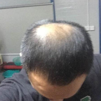 禿頂用戶圖片