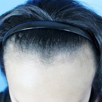 發(fā)際線用戶圖片