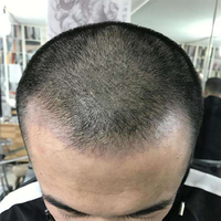 發(fā)際線用戶圖片