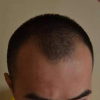 發(fā)際線用戶圖片