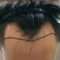 發(fā)際線用戶圖片