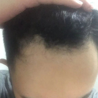 發(fā)際線用戶圖片
