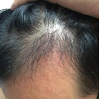 發(fā)際線用戶圖片