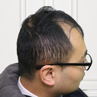 生發(fā)養(yǎng)護(hù)用戶圖片