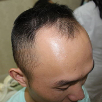 發(fā)際線用戶圖片