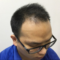 發(fā)際線用戶圖片