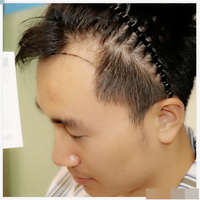發(fā)際線用戶圖片