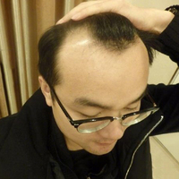 禿頂用戶圖片