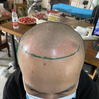 禿頂用戶圖片