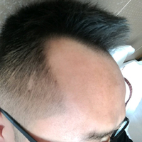 發(fā)際線用戶圖片