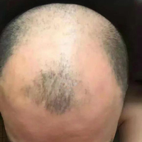 禿頂用戶圖片