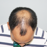 發(fā)際線用戶圖片