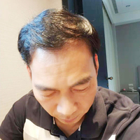 發(fā)際線用戶圖片