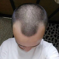 發(fā)際線用戶圖片