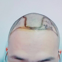 發(fā)際線用戶圖片