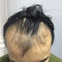 發(fā)際線用戶圖片